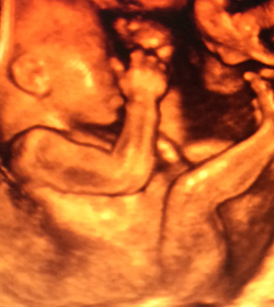 3d live ultrasound